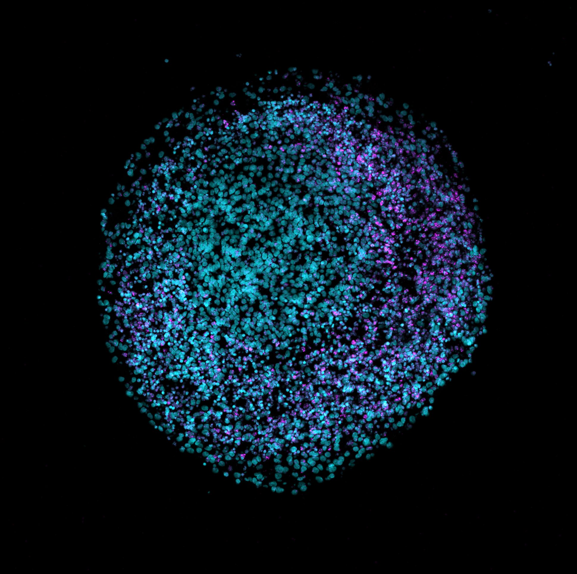 Organoïde cérébral humain observé en microscopie à fluorescence. Les noyaux cellulaires apparaissent en cyan et magenta. Image : Nreis1, CC BY 4.0, Wikimedia Commons.