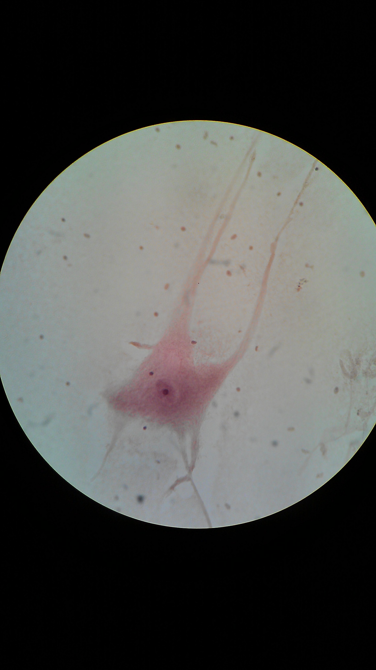 Neurone observé au microscope. Photo : Kevronichebroni, CC BY-SA 3.0.